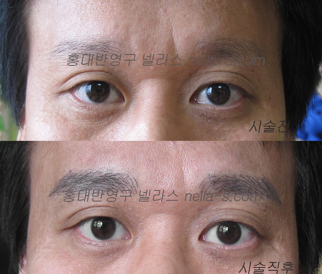 넬라스 이미지