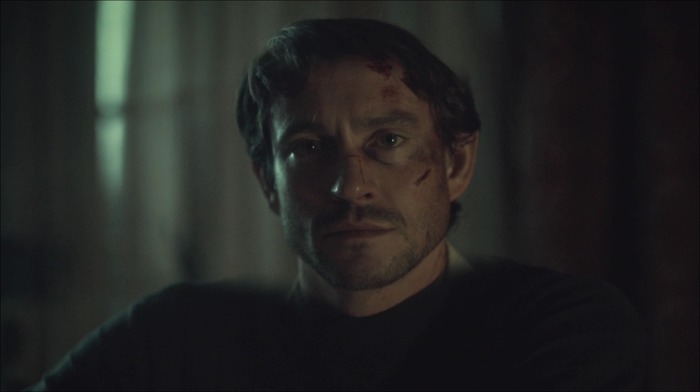 [로맨틱스릴러미드] 한니발 (Hannibal) 시즌3 에피6 (3/4) | 인스티즈