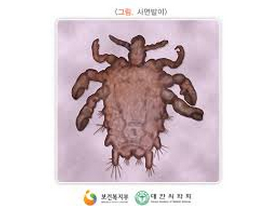 군부대에서 중대 1~2명 쯤은 걸리던 질병 (혐오주의) | 인스티즈