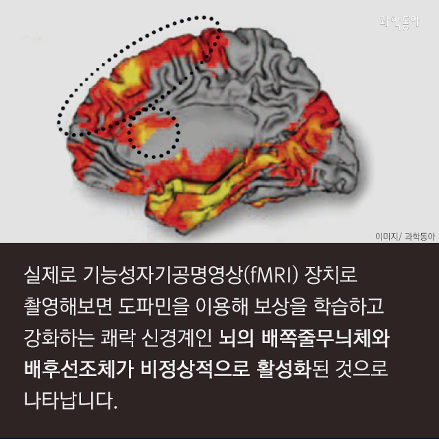 살 빼려고 굶었는데 음식 중독이라고?! | 인스티즈