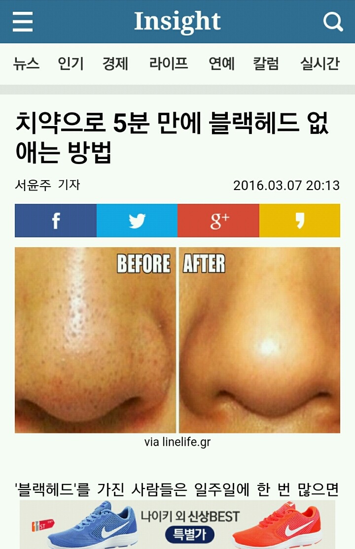 치약으로 5분만에 블랙헤드 없애는 방법 | 인스티즈