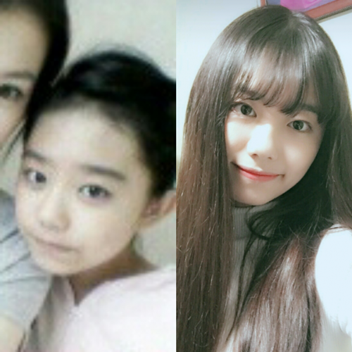 프로듀스 101 김소혜 충격적인 과거사진.JPG | 인스티즈