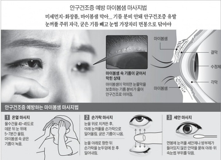 안구건조증 예방하는 마이봄샘 마사지 | 인스티즈