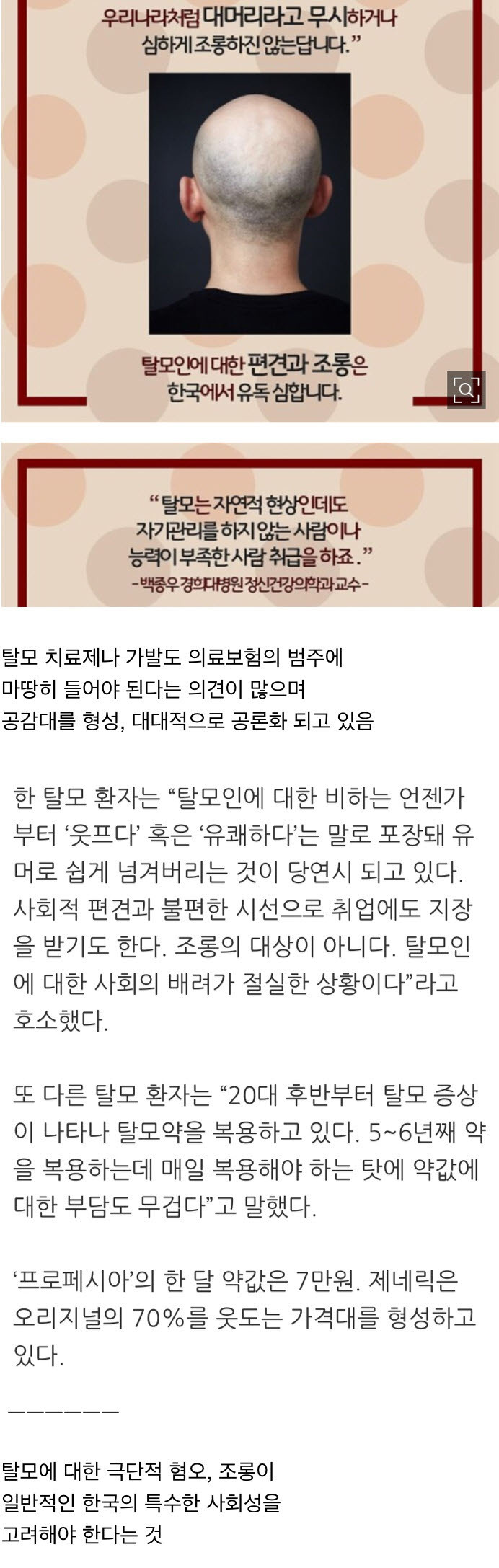 한국의 과도한 탈모혐오 | 인스티즈