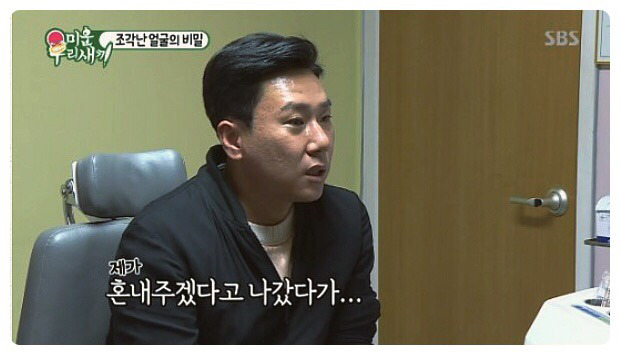 이상민 얼굴에 박혀있는 수많은 나사 | 인스티즈